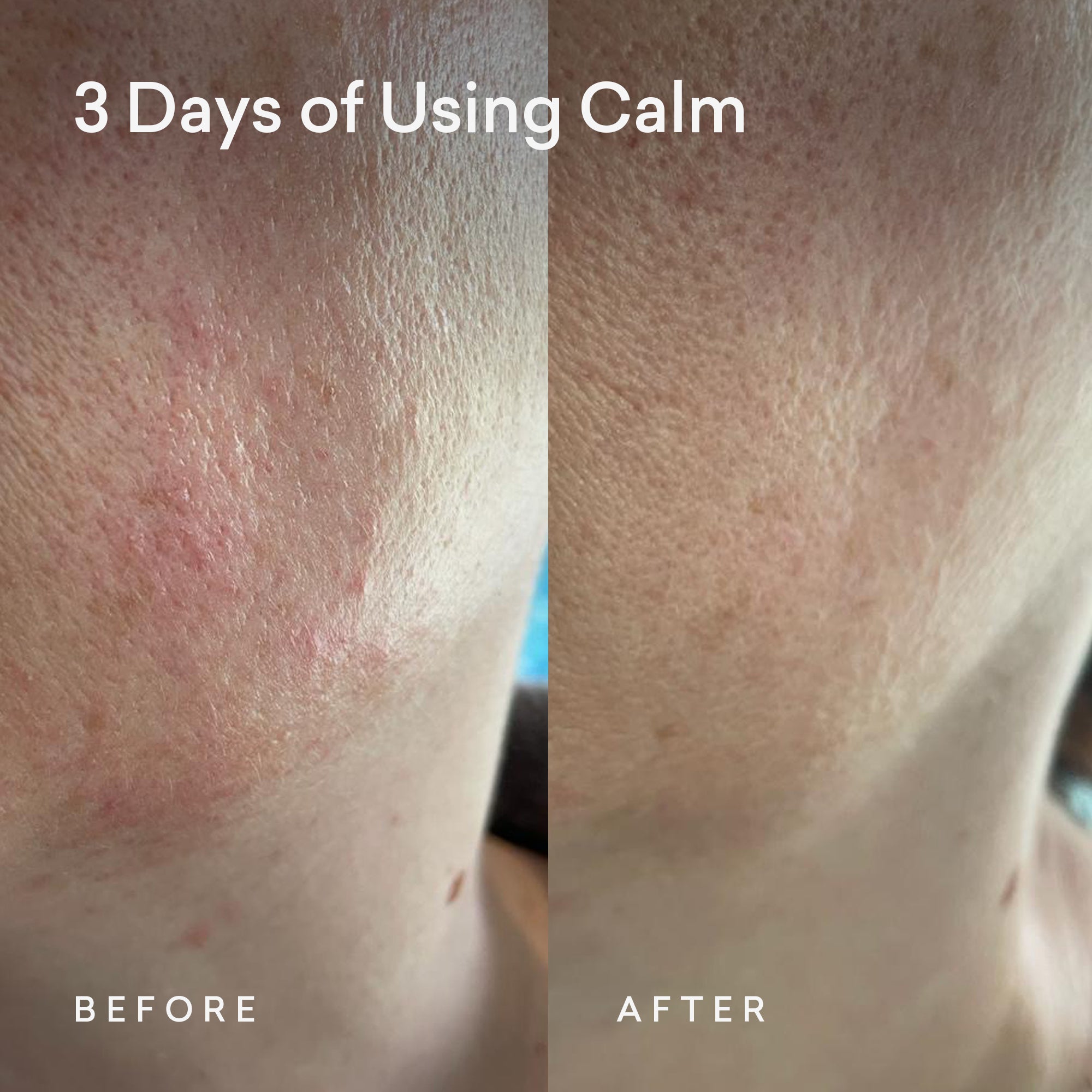 Calm Sensitive Face Oil - Mini