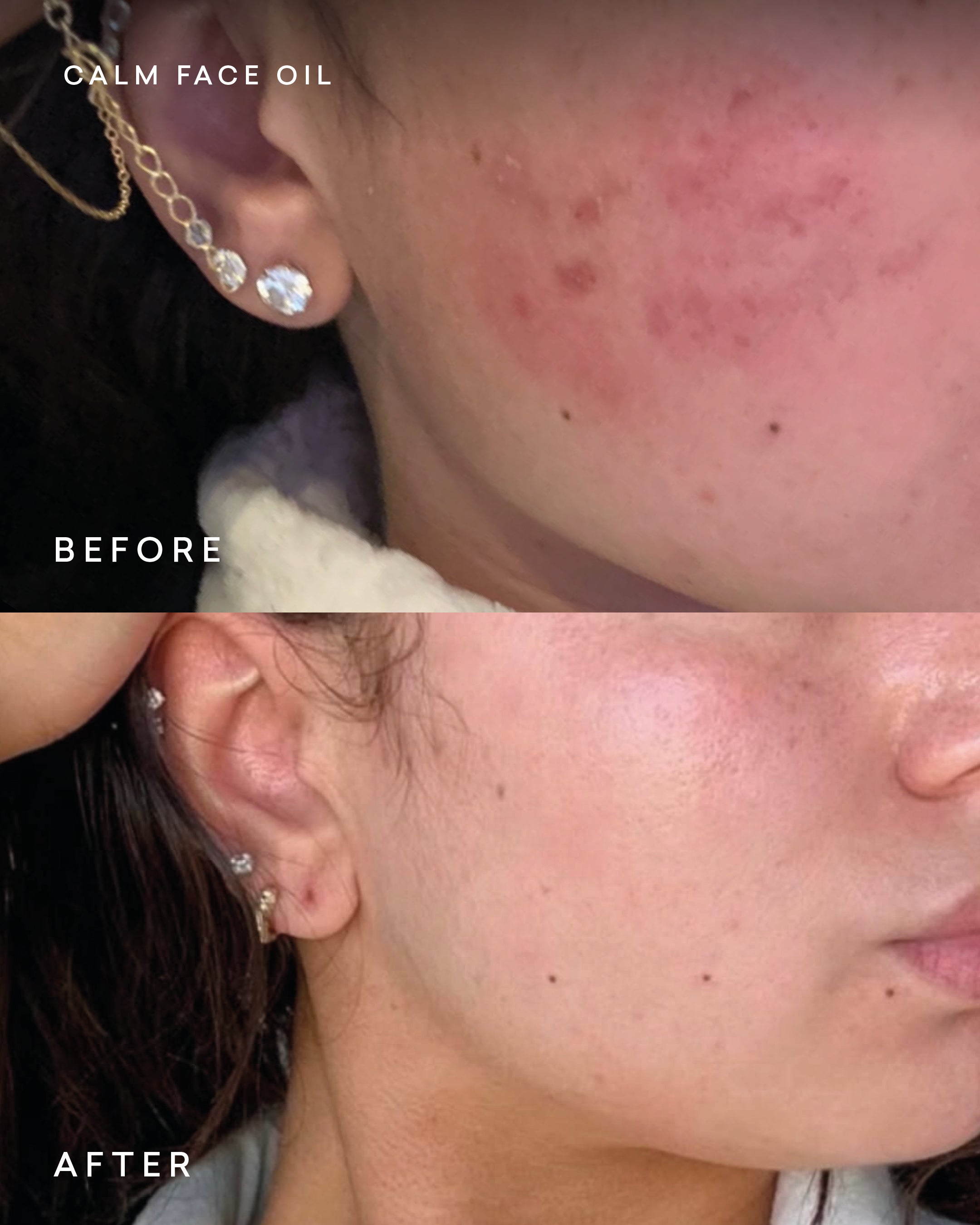 Calm Face Oil